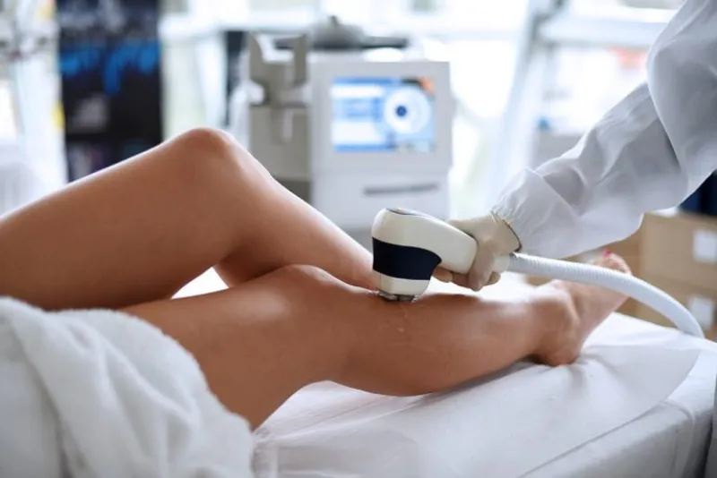 Depilazione laser sulle gambe con il Monolith